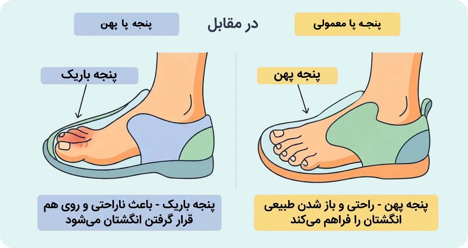 راهنمای انتخاب کفش برای پای پهن